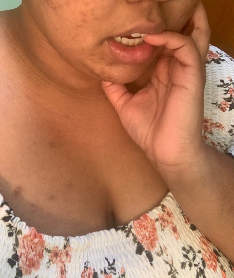 MissLunaKiss